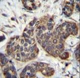 GOLT1B Antibody (aa108-136)