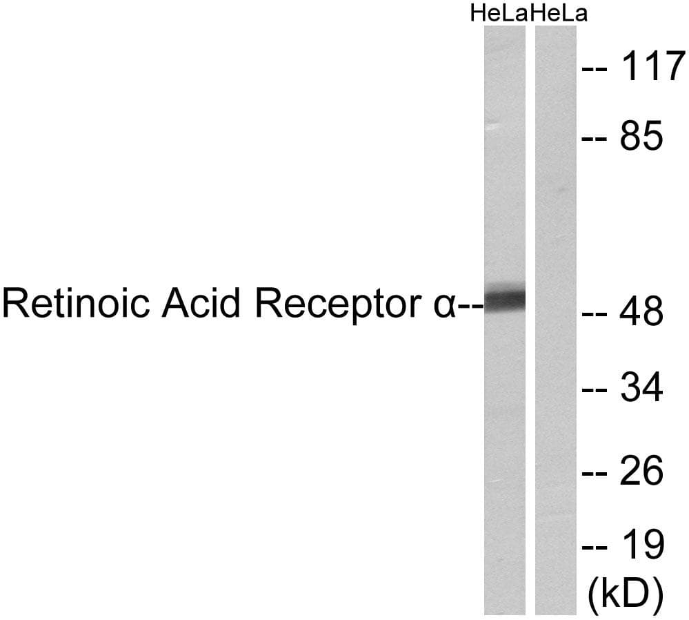 RARA / RAR Alpha Antibody (p77)