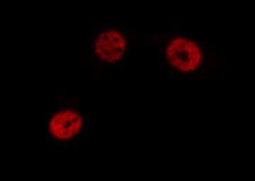Polyclonal Rabbit anti-Human DLX5 Antibody (IHC, IF, WB)
