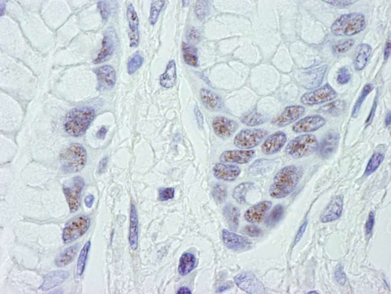 Polyclonal Rabbit anti-Human CDK11A / CDC2L2 Antibody (aa730-C-term, IHC)