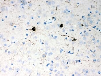 Polyclonal Rabbit anti-Human Neuropeptide Y / NPY Antibody (aa29-59, IHC)