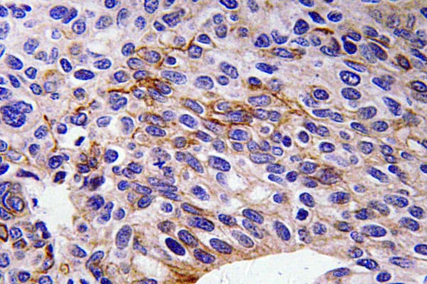 SEMA3A / Semaphorin 3A Antibody (aa688-737)