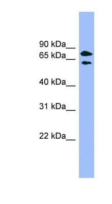 Polyclonal Rabbit anti-Human PANK4 Antibody (aa359-408, WB)