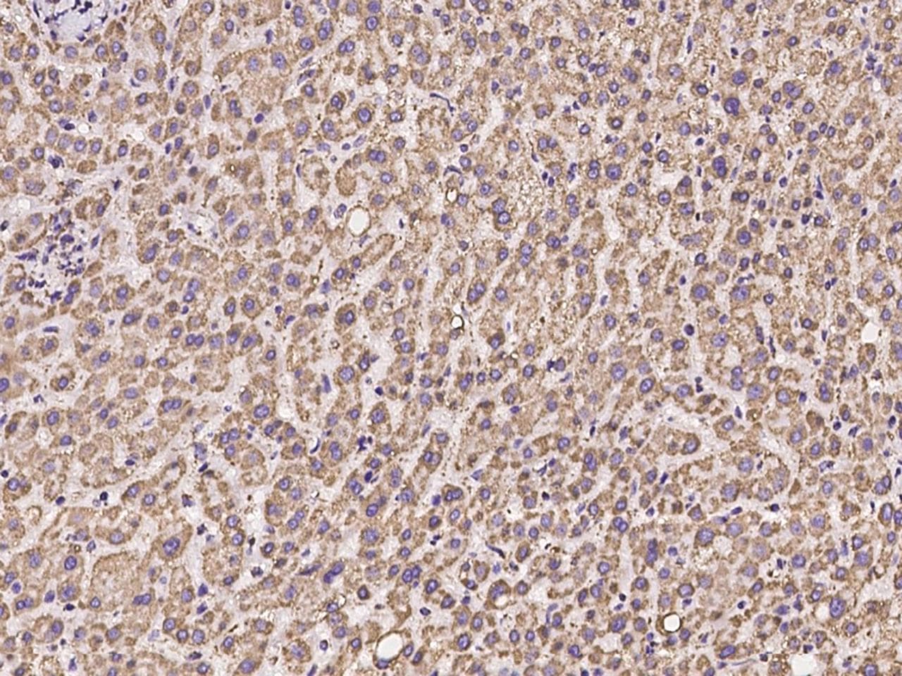 UQCRC1 Antibody