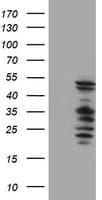 IHC-plus™ SERPINB2 / PAI-2 Antibody (clone 1G3)