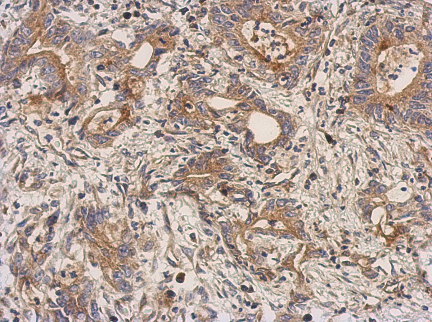 TGFB4 / LEFTY2 Antibody (aa25-366)
