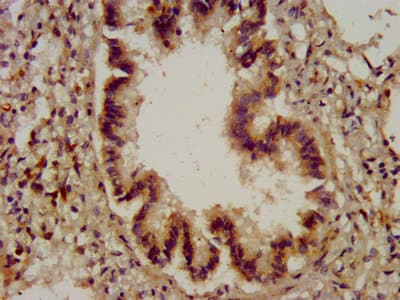 CYBA / p22phox Antibody