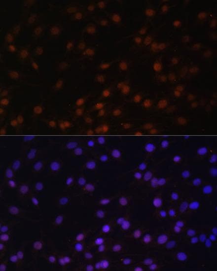 ZNF177 / PIGX Antibody