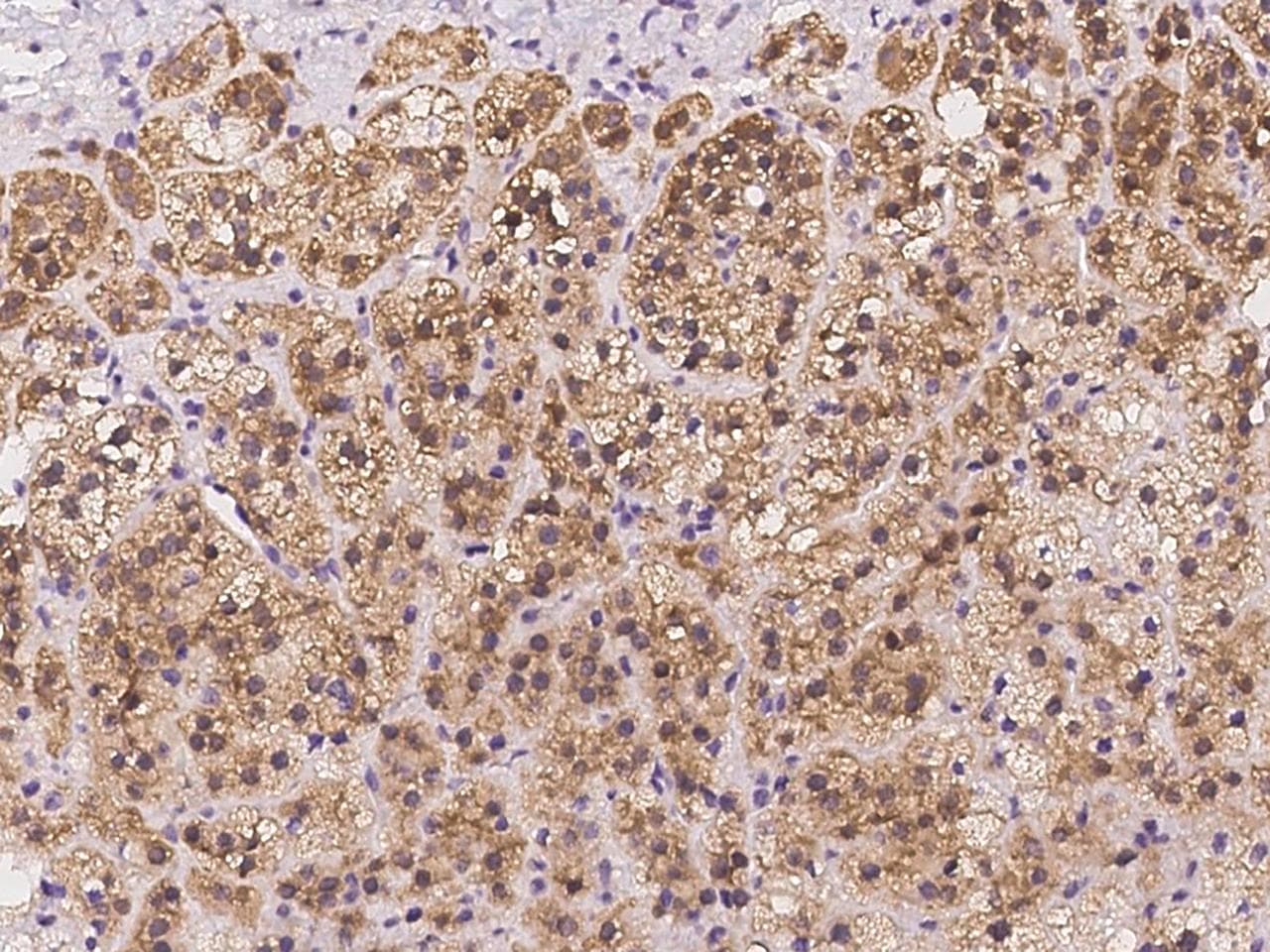 Polyclonal Rabbit anti-Human AAMDC Antibody (IHC)