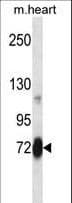 SNK / PLK2 Antibody (aa354-382)