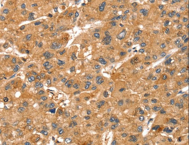 SPTAN1 / Alpha Fodrin Antibody