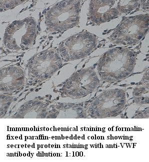 VWF / Von Willebrand Factor Antibody