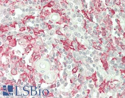 IHC-plus™ AIF1 / IBA1 Antibody
