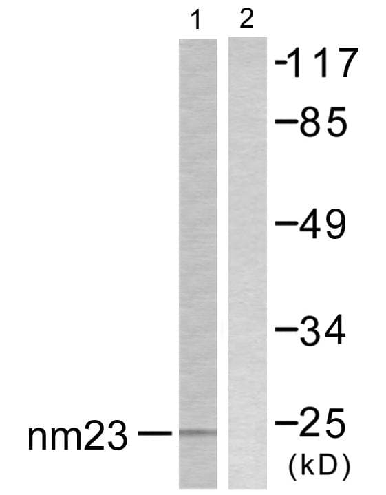 IHC-plus™ NME2 Antibody (aa91-140)
