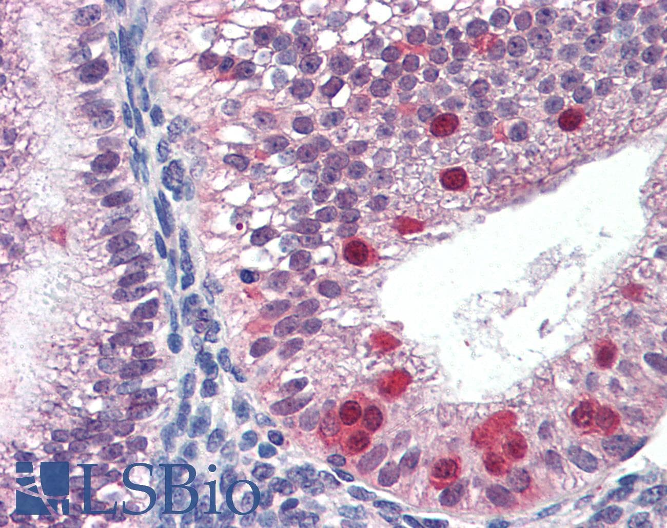 IHC-plus™ Polyclonal Goat anti-Human FANCG Antibody (aa609-622, IHC, WB)