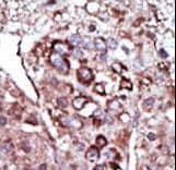 DGKZ Antibody (aa989-1019)