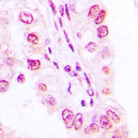 Polyclonal Rabbit anti-Human SF3B4 Antibody (Internal, IHC, WB)