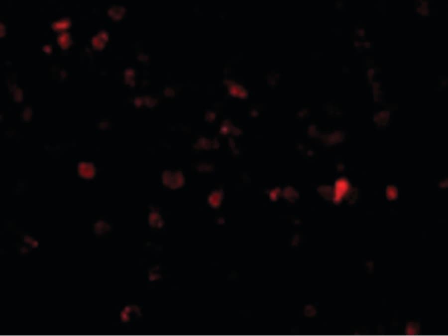 IHC-plus™ TP53AIP1 / p53 AIP1 Antibody