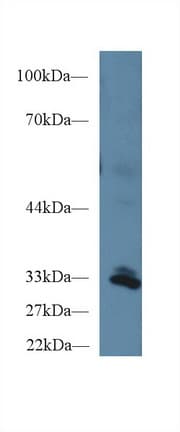 PPIE / Cyclophilin E Antibody (aa41-264)