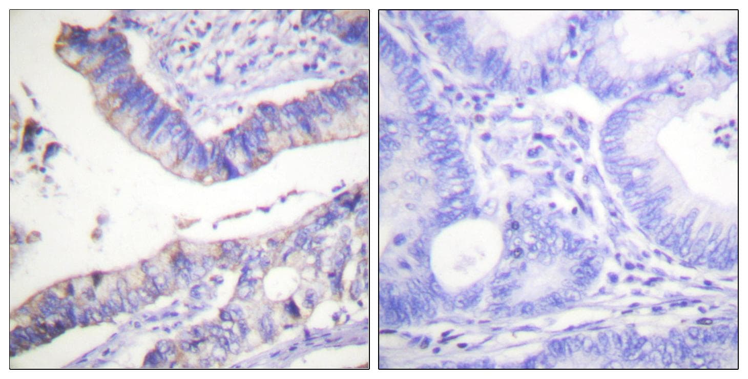 Polyclonal Rabbit anti-Human BCL2 / Bcl-2 Antibody (p69, IHC, IF, WB)