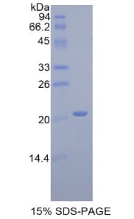 Rat IL17RE Protein (Recombinant His)