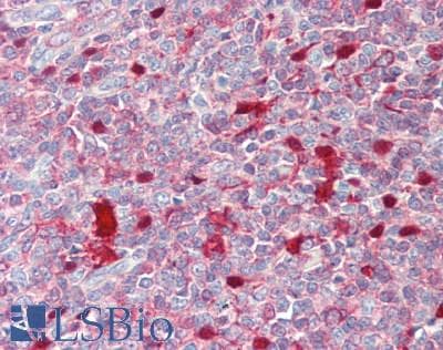 IHC-plus™ SERPINB9 / PI9 Antibody (aa1-376)