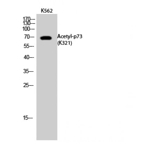 TP73 / p73 Antibody (acetylation site of K321.)