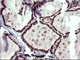 Monoclonal Mouse anti-Human UPRT Antibody (clone OTI1C9, IHC, WB)