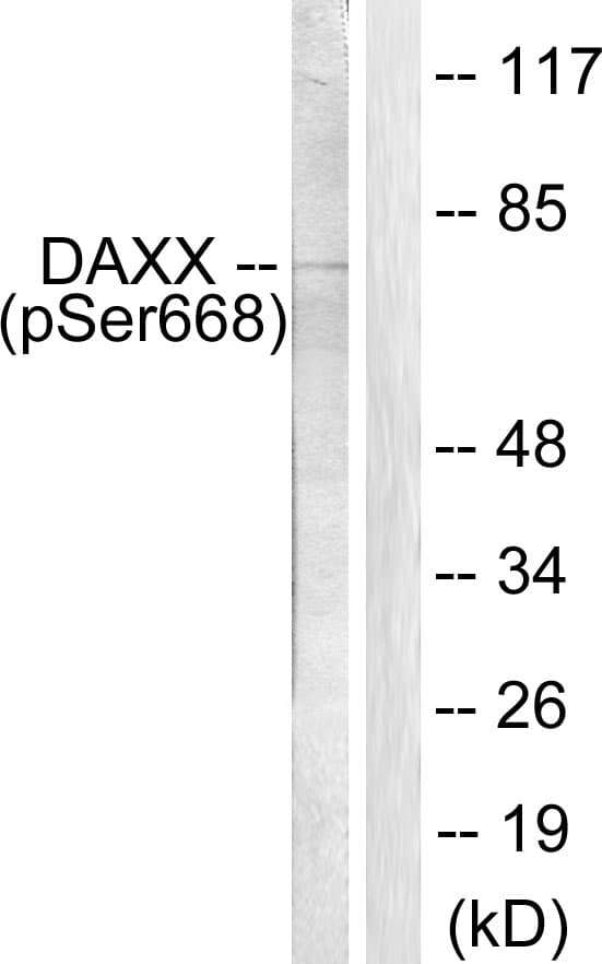 DAXX Antibody (phospho-Ser668)