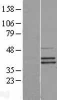 SEPHS2 Protein (Over-Expression Lysate Myc-DDK (Flag))