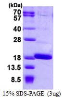Human FABP12 Protein (Recombinant His)