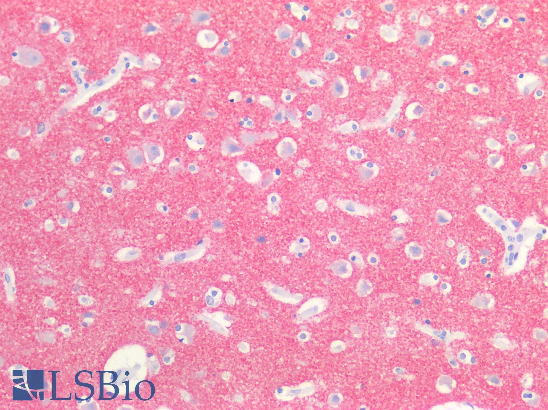 IHC-plus™ SYP / Synaptophysin Antibody