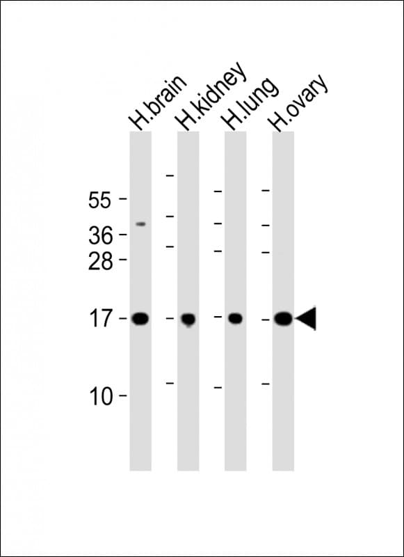 PPIAL4A Antibody (aa 66-92, Internal)