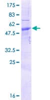 Human RNASET2 Protein (Recombinant GST)