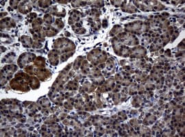 RASGRP3 / GRP3 Antibody (aa380-690, clone OTI2C9, Carrier-free)