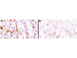 MSLN / Mesothelin Antibody (clone MB-G10)