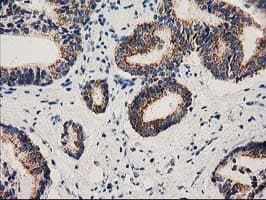 MMAB Antibody (clone OTI2G5, Carrier-free)