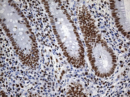 Monoclonal Mouse anti-Human RING1 Antibody (clone OTI11G7, aa88-362, IHC, WB)