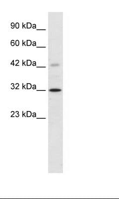 VDAC1 / PORIN Antibody (C-Terminus)