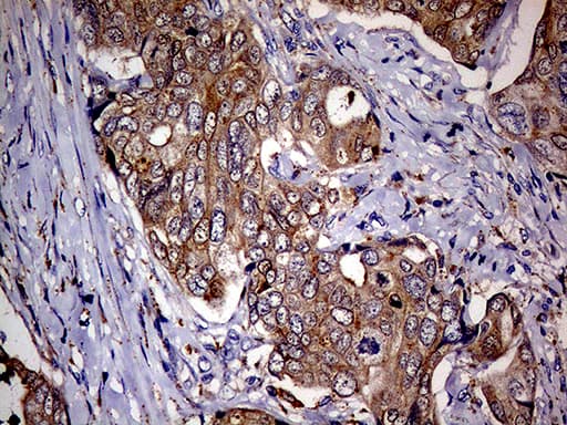 p16INK4a / CDKN2A Antibody (clone OTI11E9)