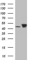 TUBB2B / Tubulin Beta 2B Antibody (clone OTI2H4, Carrier-free)