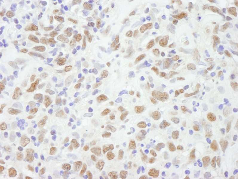 CBX5 / HP1 Alpha Antibody (aa150-C-term)