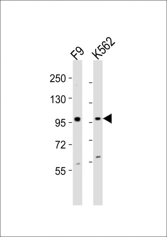 EZH2 Antibody (aa260-295)