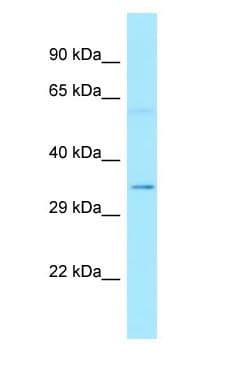 TRP32 / TXNL1 Antibody (aa201-250)