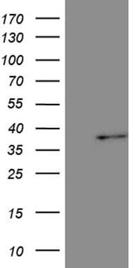 TAZ Antibody (aa45-248, clone OTI1B3)