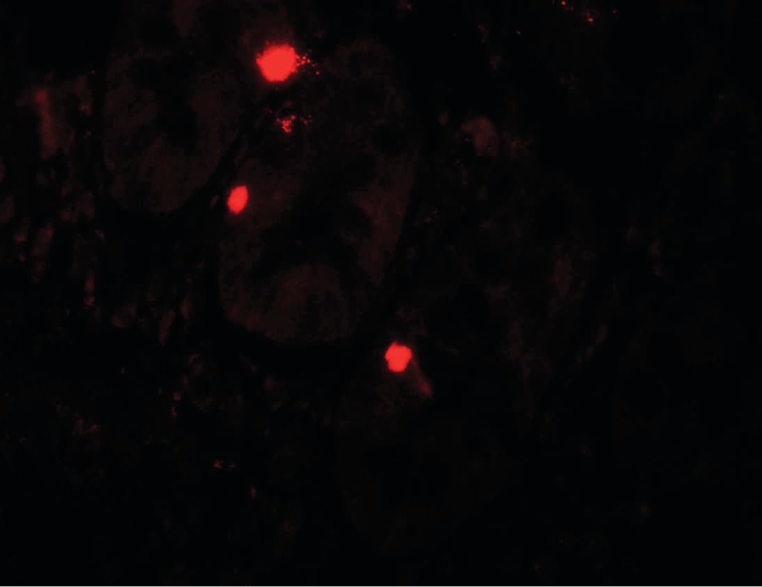 IHC-plus™ Polyclonal Rabbit anti-Human ATG14 Antibody (IHC, IF, WB)