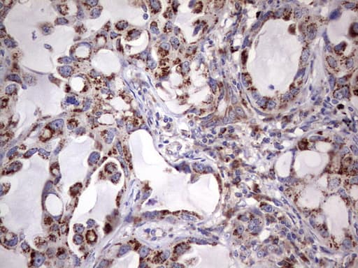Monoclonal Mouse anti-Human PPP2R5D Antibody (clone OTI5E7, IHC, WB)