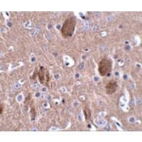 Polyclonal Rabbit anti-Human C16orf5 / I1 Antibody (IHC, IF, WB)