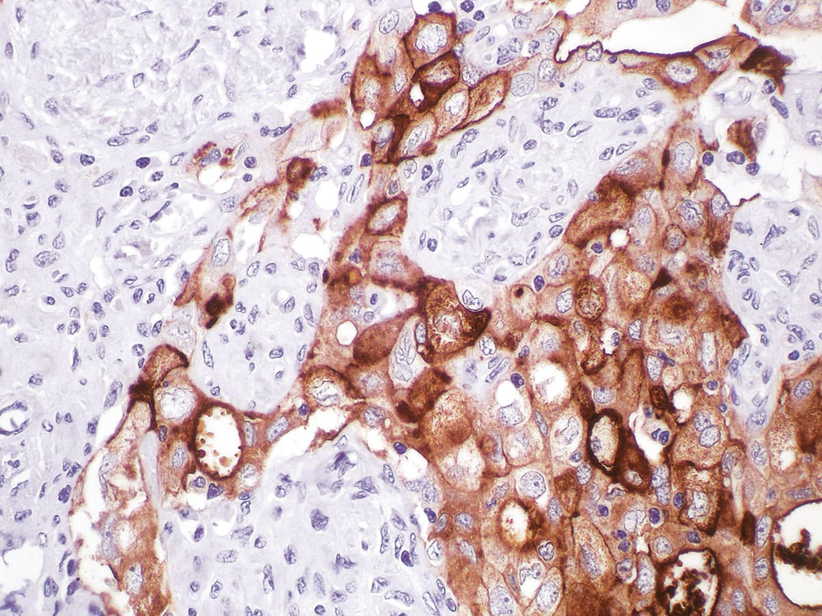 IHC-plus™ Monoclonal Mouse anti-Human CA125 Antibody (Concentrated, IHC)