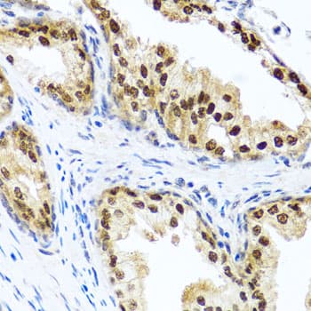 RAD23B / HR23B Antibody
